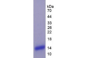 SDS-PAGE analysis of Human Plexin B1 Protein. (PLXNB1 Protein)