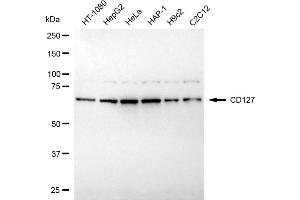 Western blotting analysis using CD127 antibody (ABIN7799108). (Rekombinanter IL7R Antikörper)