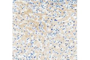 IHC analysis of HE4/WFDC2 using anti-HE4/WFDC2 antibody (ABIN5693137). (WFDC2 Antikörper  (AA 31-124))