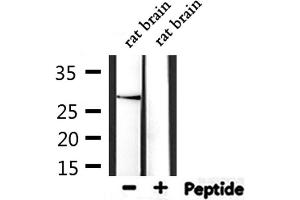 Western blot analysis of extracts from rat brain, using THY1 Antibody. (CD90 Antikörper  (Internal Region))