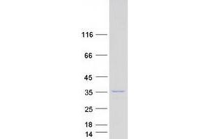 Western Blotting (WB) image for AlkB, Alkylation Repair Homolog 2 (ALKBH2) (Transcript Variant 3) protein (Myc-DYKDDDDK Tag) (ABIN2714578)