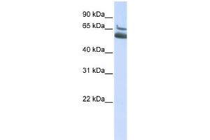 WB Suggested Anti-ALOX15B Antibody Titration:  0. (ALOX15B Antikörper  (N-Term))