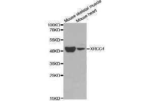 Western blot analysis of extracts of various cell lines, using XRCC4 antibody. (XRCC4 Antikörper  (AA 1-336))