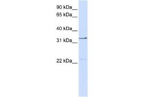 WB Suggested Anti-GTF2E2 Antibody Titration:  0.