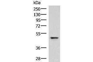 Western blot analysis of Human fetal liver tissue lysate using RMDN2 Polyclonal Antibody at dilution of 1:750