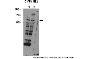 Sample type: 1. (CYP11B2 Antikörper  (Middle Region))