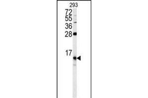 FKBP1B antibody  (N-Term)
