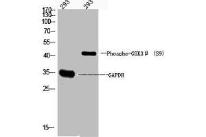 Western Blot analysis of 293 cells using Phospho-GSK3β (S9) Polyclonal Antibody (GSK3 beta Antikörper  (pSer9))