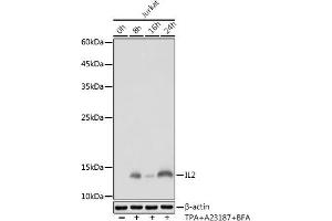 Western blot analysis of extracts of Jurkat cells, using IL2 antibody (ABIN7267993) at 1:1000 dilution. (IL-2 Antikörper)