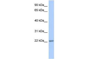 WB Suggested Anti-TRAPPC5 Antibody Titration: 0. (TRAPPC5 Antikörper  (Middle Region))