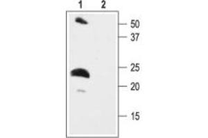 Western Blotting (WB) image for anti-Potassium Voltage-Gated Channel, Isk-Related Family, Member 2 (KCNE2) (AA 88-107), (Intracellular) antibody (ABIN7043499)