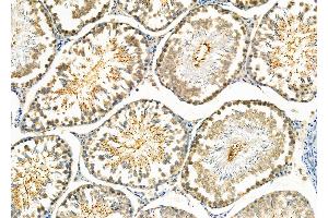 ABIN6260488 and ABIN6273998 at 1/100 staining Rat testis tissue by IHC-P. (Caspase 2 Antikörper  (Internal Region))