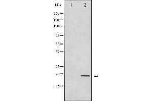 Western blot analysis of Synuclein- alpha phosphorylation expression in Etoposide treated 293 whole cell lysates,The lane on the left is treated with the antigen-specific peptide. (SNCA Antikörper  (pTyr133))