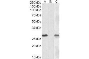 Lane A: AP23775PU-N 1µg/ml) staining of HEK293 overexpressing Human DYDC1 lysate (10µg protein in RIPA buffer). (DYDC1 Antikörper  (Internal Region))