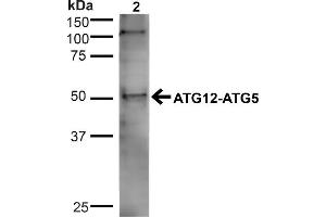 Western blot analysis of Human Cervical cancer cell line (HeLa) lysate showing detection of ~32. (ATG5 Antikörper  (N-Term) (Alkaline Phosphatase (AP)))