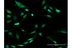 Immunofluorescence of purified MaxPab antibody to GALT on HeLa cell.
