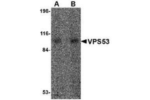 Western blot analysis of VPS53 in 293 cell lysate with VPS53 antibody at (A) 0. (VPS53 Antikörper  (Center))