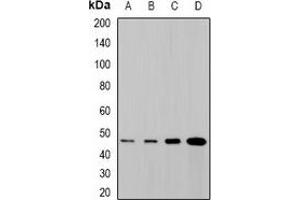 Western blot analysis of SYT4 expression in SHSY5Y (A), NIH3T3 (B), mouse brain (C), rat brain (D) whole cell lysates. (SYT4 Antikörper)