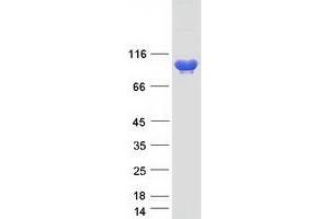 Validation with Western Blot (AMPD3 Protein (Transcript Variant 3) (Myc-DYKDDDDK Tag))