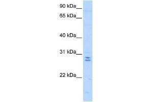 Western Blot showing MED4 antibody used at a concentration of 0. (MED4 Antikörper  (C-Term))