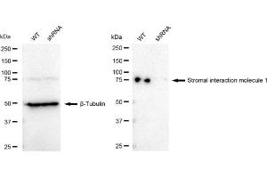 Western blotting analysis using Stromal interaction molecule 1 antibody (ABIN7800445). (Rekombinanter STIM1 Antikörper)