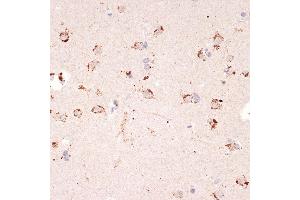 Immunohistochemistry of paraffin-embedded human brain using Ephrin  Rabbit mAb (ABIN7266976) at dilution of 1:100 (40x lens). (Ephrin A1 Antikörper)