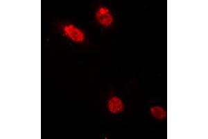 Immunofluorescent analysis of c-Myb staining in HeLa cells.