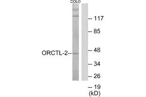 Western Blotting (WB) image for anti-Solute Carrier Family 22 Member 18 (SLC22A18) (C-Term) antibody (ABIN1849892) (ORCTL-2/SLC22A18 Antikörper  (C-Term))