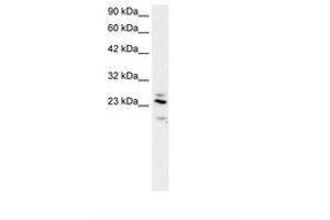 RGS20 antibody  (AA 127-176)
