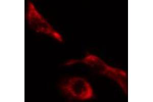 ABIN6274623 staining HeLa cells by IF/ICC. (COL5A1 Antikörper  (Internal Region))