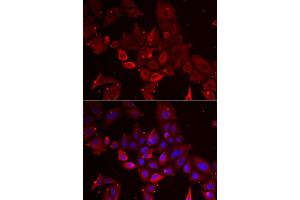 Immunofluorescence analysis of U2OS cell using MYOT antibody. (Myotilin Antikörper)