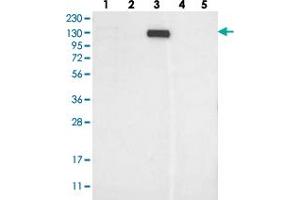 Western blot analysis of Lane 1: RT-4, Lane 2: U-251 MG, Lane 3: Human Plasma, Lane 4: Liver, Lane 5: Tonsil with MKL1 polyclonal antibody  at 1:250-1:500 dilution. (MKL1 Antikörper)