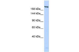 Western Blot showing JMJD3 antibody used at a concentration of 1-2 ug/ml to detect its target protein. (Kdm6b Antikörper  (N-Term))
