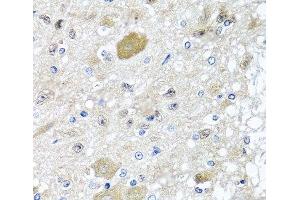 Immunohistochemistry of paraffin-embedded Rat brain using CST1 Polyclonal Antibody at dilution of 1:100 (40x lens).