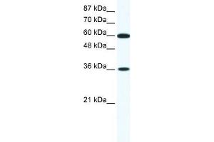 Human Jurkat; WB Suggested Anti-FOXF1 Antibody Titration: 1.