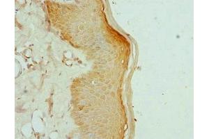 Immunohistochemistry of paraffin-embedded human skin tissue using ABIN7157648 at dilution of 1:100 (KIF2B Antikörper  (AA 544-673))