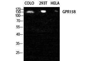 Western Blotting (WB) image for anti-G Protein-Coupled Receptor 158 (GPR158) (N-Term) antibody (ABIN3184869) (GPR158 Antikörper  (N-Term))