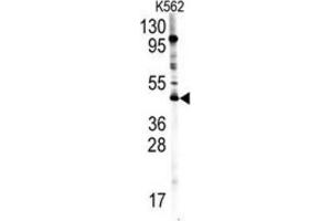 Western Blotting (WB) image for anti-Protein Arginine Methyltransferase 8 (PRMT8) antibody (ABIN2996585)