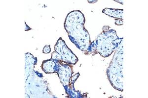 Immunohistochemistry of paraffin-embedded human placenta using MUC1 Rabbit pAb (ABIN6131522, ABIN6144194, ABIN6144195 and ABIN6213810) at dilution of 1:100 (40x lens). (MUC1 Antikörper  (AA 1182-1255))
