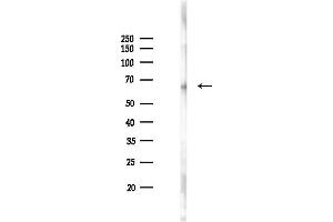Western blot analysis of lysates from Mouse liver, using Phospho-HSF1 (Ser121) Antibody at 1/1000 dilution.