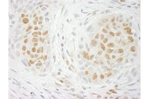 Immunohistochemistry (IHC) image for anti-G Protein-Coupled Receptor Kinase Interactor 2 (GIT2) (AA 500-550) antibody (ABIN7448581)