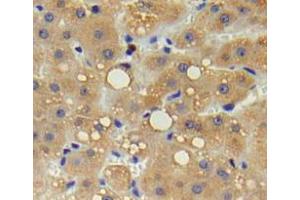 Used in DAB staining on fromalin fixed paraffin-embedded liver tissue (IL17 Receptor B Antikörper  (AA 61-200))