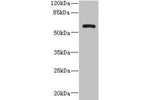 ZCCHC4 Antikörper  (AA 25-229)