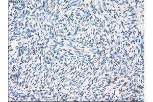Immunohistochemical staining of paraffin-embedded colon tissue using anti-PPP5Cmouse monoclonal antibody. (PP5 Antikörper)