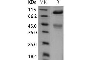 Western Blotting (WB) image for Met Proto-Oncogene (MET) (Active) protein (His tag) (ABIN7196994) (c-MET Protein (His tag))