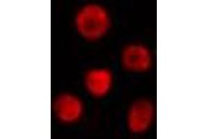 ABIN6274314 staining Hela cells by IF/ICC. (CREM Antikörper  (Internal Region))