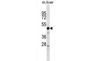 Western Blotting (WB) image for anti-Protease, serine, 16 (Thymus) (PRSS16) antibody (ABIN2998848) (PRSS16 Antikörper)