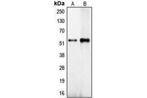 Western blot analysis of CEP57 expression in NT2D1 (A), HeLa (B) whole cell lysates.