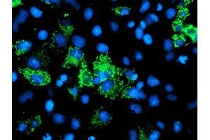 Anti-AK4 mouse monoclonal antibody (ABIN2454652) immunofluorescent staining of COS7 cells transiently transfected by pCMV6-ENTRY AK4 (RC220572). (AK4 Antikörper)