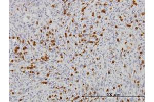 Image no. 2 for anti-Gardner-Rasheed Feline Sarcoma Viral (V-Fgr) Oncogene Homolog (FGR) (AA 1-90) antibody (ABIN598685) (Fgr Antikörper  (AA 1-90))